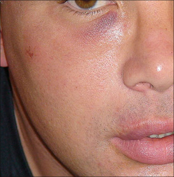 الأرواح الشريرة تلاحق امرأة وتلكمها بشدة على جسدها! صورة رقم 3 الأرواح الشريرة تلاحق امرأة وتلكمها بشدة على جسدها! صورة رقم 3