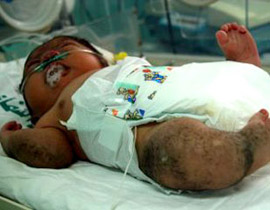 ولادة طفل على شكل غوريلا.. وأهله يرفضون اصطحابه للمنزل صورة رقم 1 ولادة طفل على شكل غوريلا.. وأهله يرفضون اصطحابه للمنزل صورة رقم 1