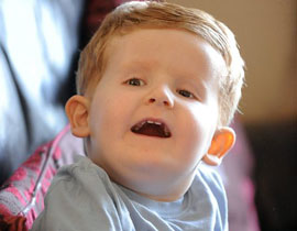 حالة هي الاولى من نوعها.. طفل يولد بشريط حمض نووي اضافي! صورة رقم 1 حالة هي الاولى من نوعها.. طفل يولد بشريط حمض نووي اضافي! صورة رقم 1