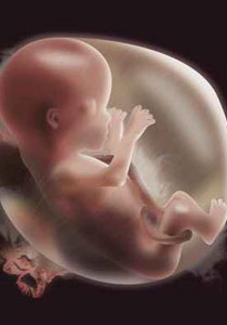 الاجنة الميتة تتسبب في الاجنة الميتة تتسبب في