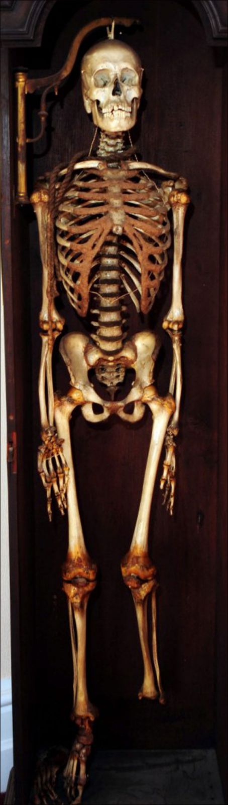 دفن ولكن.. بعد مرور 190 عاما على شنقه!!  صورة رقم 7