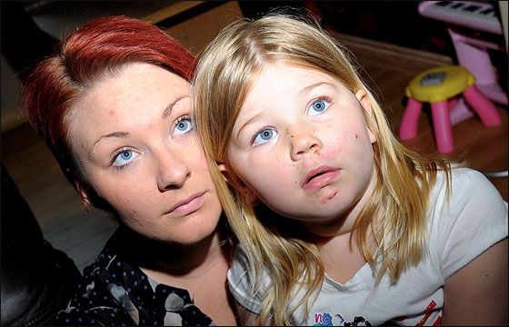 مراهق يهشم وجه طفلة بقطعة قرميد ألقاها على وجهها! صورة رقم 5 مراهق يهشم وجه طفلة بقطعة قرميد ألقاها على وجهها! صورة رقم 5