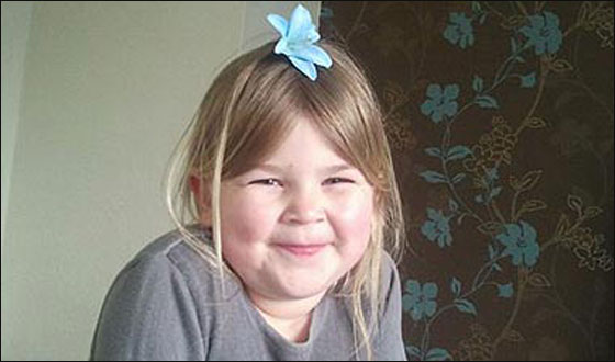 مراهق يهشم وجه طفلة بقطعة قرميد ألقاها على وجهها! صورة رقم 4 مراهق يهشم وجه طفلة بقطعة قرميد ألقاها على وجهها! صورة رقم 4