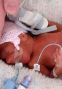 بعد 8 مرات من الحمل غير المكتمل.. ام تنجب مولودها الاول! صورة رقم 1 بعد 8 مرات من الحمل غير المكتمل.. ام تنجب مولودها الاول! صورة رقم 1