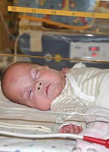 ألمانية تلد طفلة بعد 21 أسبوعا من الحمل في أبكر ولادة في العالم!! صورة رقم 1 ألمانية تلد طفلة بعد 21 أسبوعا من الحمل في أبكر ولادة في العالم!! صورة رقم 1