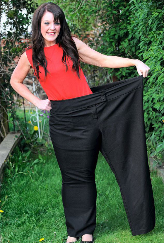 خسرت اكثر من نصف وزنها وما زالت تتقلص بعد التفاف معدتها! صورة رقم 3