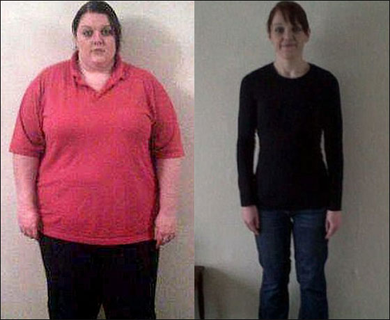 خسرت اكثر من نصف وزنها وما زالت تتقلص بعد التفاف معدتها! صورة رقم 2