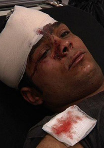 في يوم العمال: جنود الاحتلال يحطمون رأس عامل فلسطيني!  صورة رقم 1