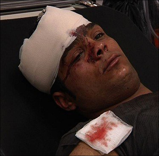 في يوم العمال: جنود الاحتلال يحطمون رأس عامل فلسطيني!  صورة رقم 5