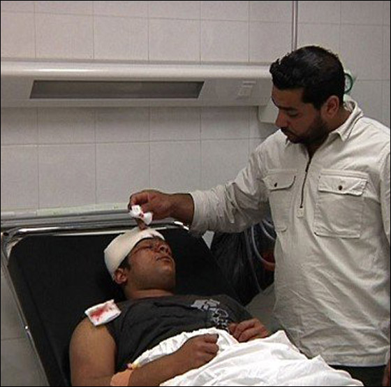 في يوم العمال: جنود الاحتلال يحطمون رأس عامل فلسطيني!  صورة رقم 3