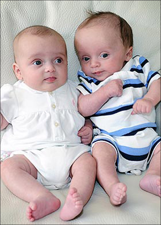 صفار البيض وزيت الصويا يحققان حلم بريطانية بانجاب توأمين!!  صورة رقم 3