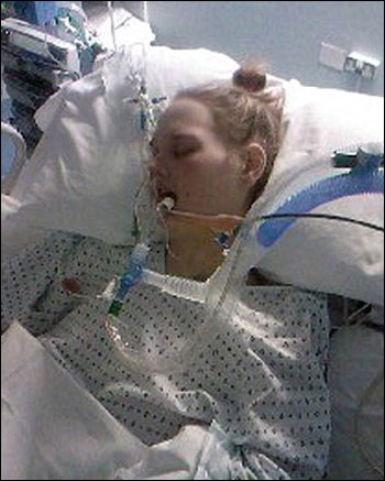 محزن: عملية تصغير المعدة تمنع فتاة من الاكل وتهدد حياتها!  صورة رقم 3