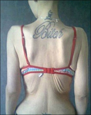 محزن: عملية تصغير المعدة تمنع فتاة من الاكل وتهدد حياتها!  صورة رقم 5