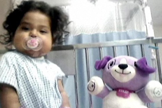 شفاء رضيعة من مرض خلقي نادر بعد عملية زراعة 7 اعضاء!!  صورة رقم 3