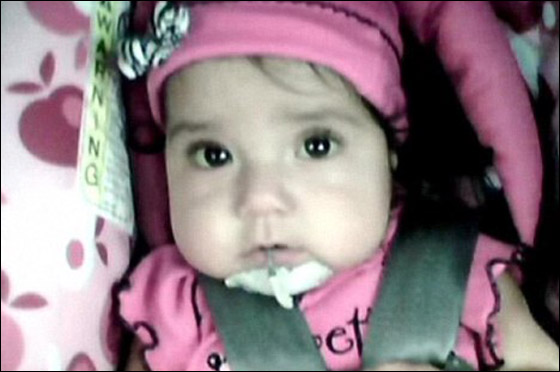 شفاء رضيعة من مرض خلقي نادر بعد عملية زراعة 7 اعضاء!!  صورة رقم 4