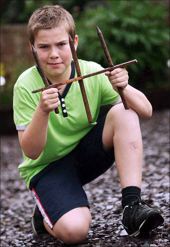 فتى ينجو باعجوبة بعدما بقي معلقا من رجله في قضبان حديدية صدئة!  صورة رقم 3