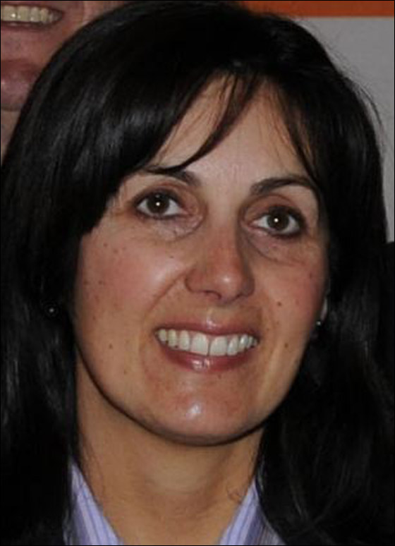 تعويض سيدة بـ6 ملايين جنيه بعد خسارة عملها بسبب عملية تجميل! صورة رقم 2