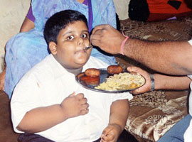 لاول مرة في التاريخ: طفل يخضع لعملية تصغير معدة بنجاح! صورة رقم 1 لاول مرة في التاريخ: طفل يخضع لعملية تصغير معدة بنجاح! صورة رقم 1