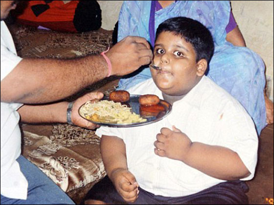 لاول مرة في التاريخ: طفل يخضع لعملية تصغير معدة بنجاح! صورة رقم 2 لاول مرة في التاريخ: طفل يخضع لعملية تصغير معدة بنجاح! صورة رقم 2