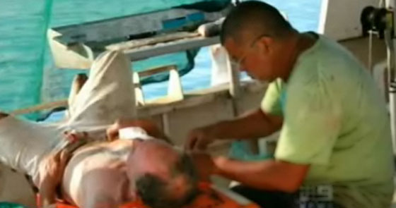 للمرة الثالثة في شهر واحد.. تمساح يهاجم طبيب اسنان! صورة رقم 2