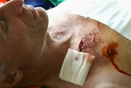 للمرة الثالثة في شهر واحد.. تمساح يهاجم طبيب اسنان! صورة رقم 3