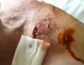 للمرة الثالثة في شهر واحد.. تمساح يهاجم طبيب اسنان! صورة رقم 1