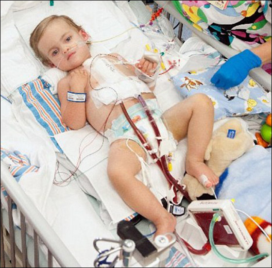 معجزة: طفل ينجو من فشل في القلب والرئة عقب جلطة دماغية!! صورة رقم 4