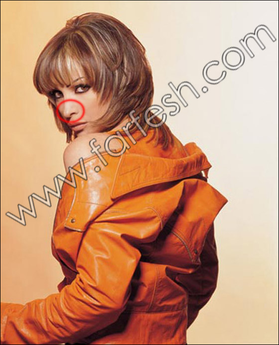 بالصور.. عيوب جسدية وتشوهات خلقية لدى الفنانات العربيات!! صورة رقم 5 بالصور.. عيوب جسدية وتشوهات خلقية لدى الفنانات العربيات!! صورة رقم 5