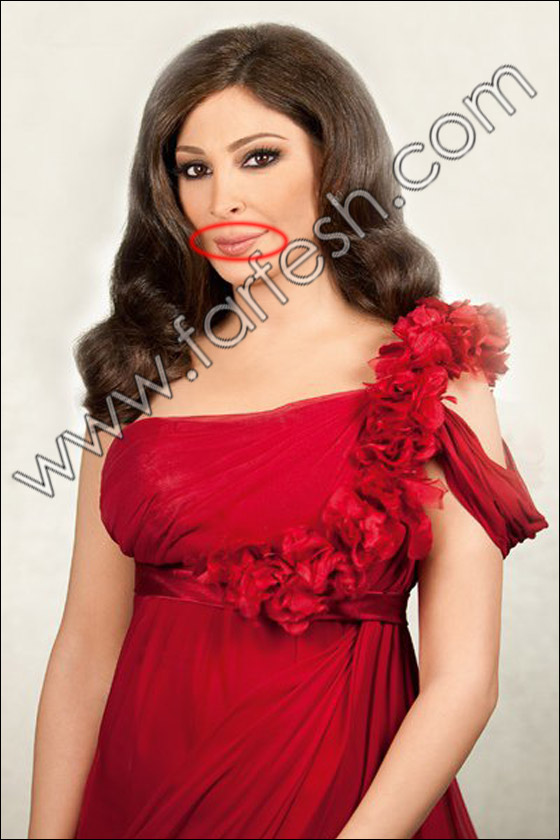 بالصور.. عيوب جسدية وتشوهات خلقية لدى الفنانات العربيات!! صورة رقم 2 بالصور.. عيوب جسدية وتشوهات خلقية لدى الفنانات العربيات!! صورة رقم 2