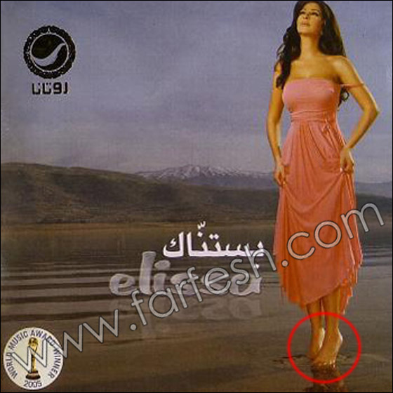 بالصور.. عيوب جسدية وتشوهات خلقية لدى الفنانات العربيات!! صورة رقم 3 بالصور.. عيوب جسدية وتشوهات خلقية لدى الفنانات العربيات!! صورة رقم 3