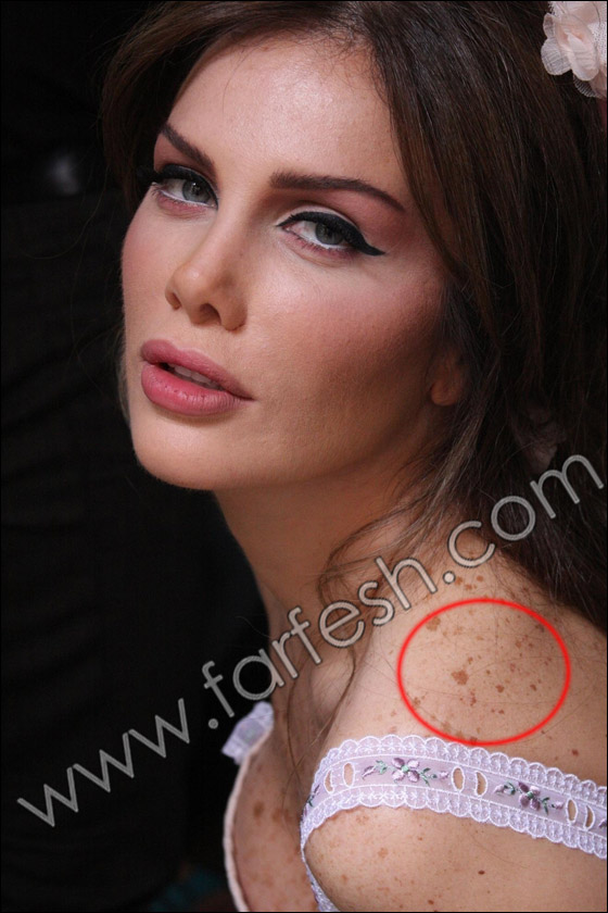 بالصور.. عيوب جسدية وتشوهات خلقية لدى الفنانات العربيات!! صورة رقم 6 بالصور.. عيوب جسدية وتشوهات خلقية لدى الفنانات العربيات!! صورة رقم 6