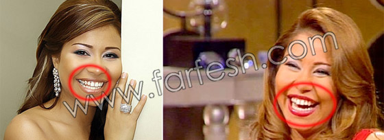 بالصور.. عيوب جسدية وتشوهات خلقية لدى الفنانات العربيات!! صورة رقم 7 بالصور.. عيوب جسدية وتشوهات خلقية لدى الفنانات العربيات!! صورة رقم 7