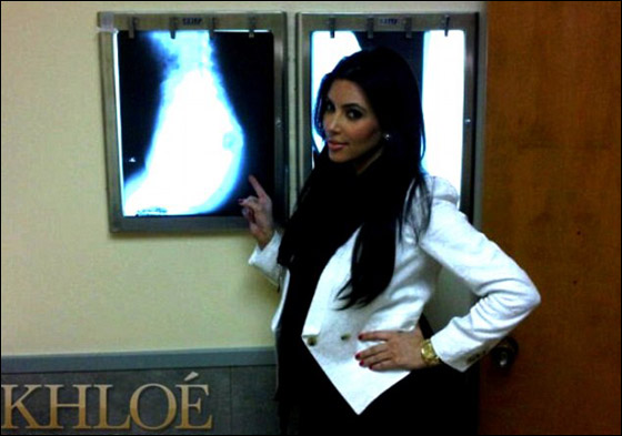 الحقيقة اخيرا: هل خضعت كيم لعملية تجميل في المؤخرة؟!  صورة رقم 1