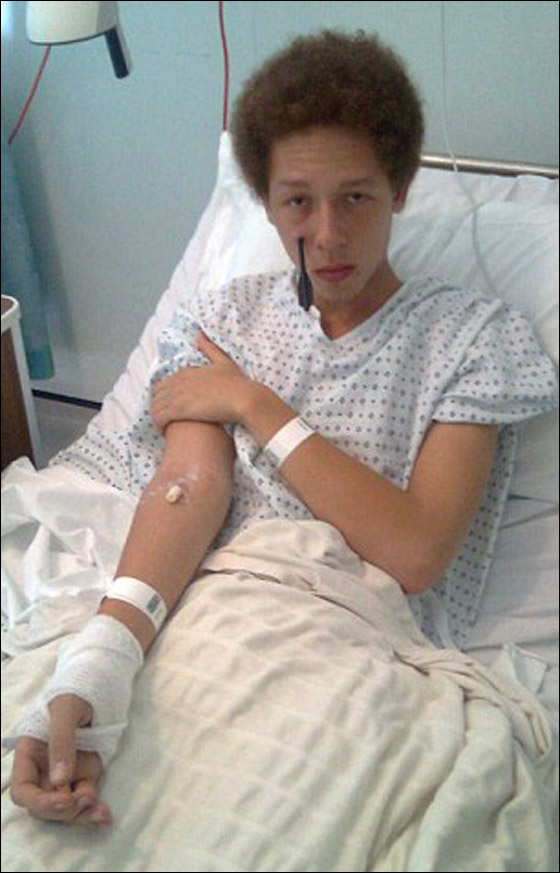 نجا باعجوبة بعد أن اخترق سهم خده الايمن بعمق 20 سم!!  صورة رقم 3