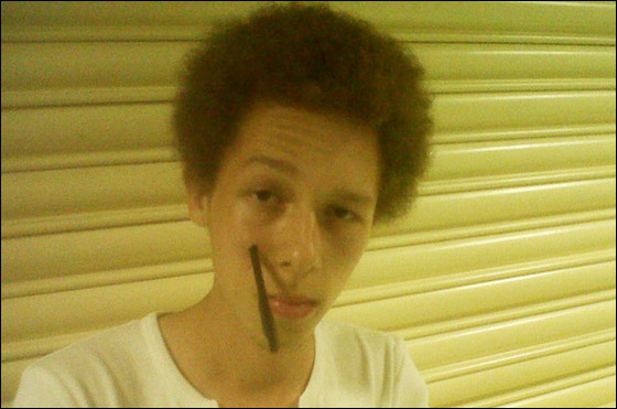 نجا باعجوبة بعد أن اخترق سهم خده الايمن بعمق 20 سم!!  صورة رقم 4