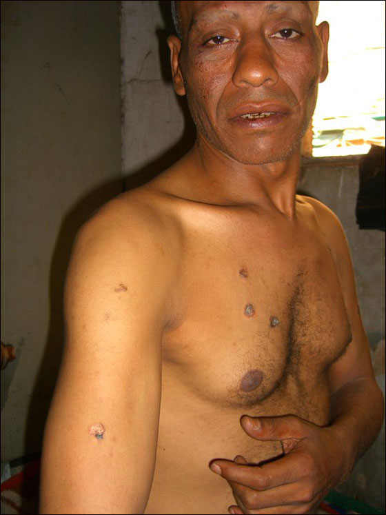 ابو المعاطي: ضباط مصريين عذبوني وهتكوا عرضي وحلقوا لي صورة رقم 2