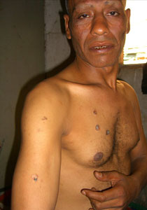 ابو المعاطي: ضباط مصريين عذبوني وهتكوا عرضي وحلقوا لي صورة رقم 1