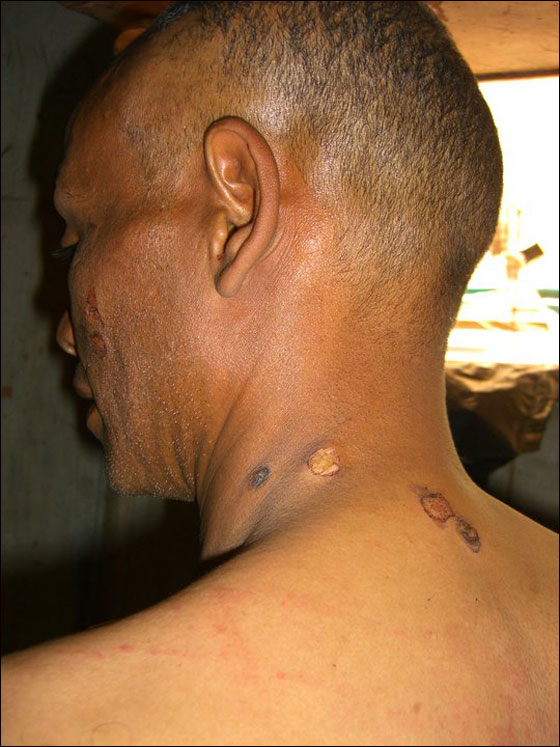 ابو المعاطي: ضباط مصريين عذبوني وهتكوا عرضي وحلقوا لي صورة رقم 3