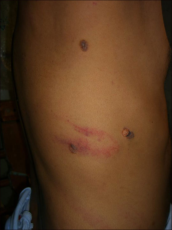 ابو المعاطي: ضباط مصريين عذبوني وهتكوا عرضي وحلقوا لي صورة رقم 5