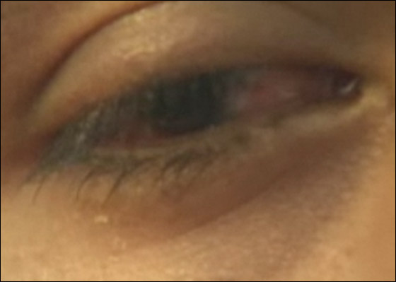 عامل يفقد بصره جراء تفجر عبوة جعة في وجهه! صورة رقم 2 عامل يفقد بصره جراء تفجر عبوة جعة في وجهه! صورة رقم 2