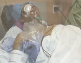 عامل يفقد بصره جراء تفجر عبوة جعة في وجهه! صورة رقم 1 عامل يفقد بصره جراء تفجر عبوة جعة في وجهه! صورة رقم 1