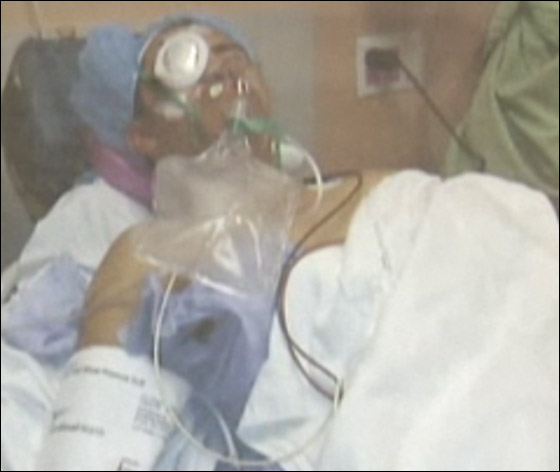 عامل يفقد بصره جراء تفجر عبوة جعة في وجهه! صورة رقم 3 عامل يفقد بصره جراء تفجر عبوة جعة في وجهه! صورة رقم 3