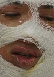 شاب امريكي: صديق والدتي الغيور حرقني اثناء نومي وشوه وجهي!! صورة رقم 1