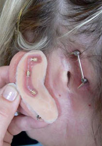 اعتادت على التسفع 15 ساعة يوميا.. فاصيبت بسرطان الاذن!! صورة رقم 1