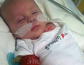 في حالة نادرة جدا: طفل بعمر الشهر يتغلب على السحايا 