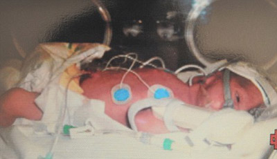 طفل ينجو باعجوبة بعد ان نزف كل دمائه وتوقف نبضه عقب ولادته!! صورة رقم 4