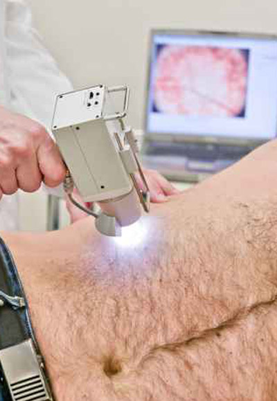 استئصال جنين غير مكتمل من بطن شاب مصري! صورة رقم 1