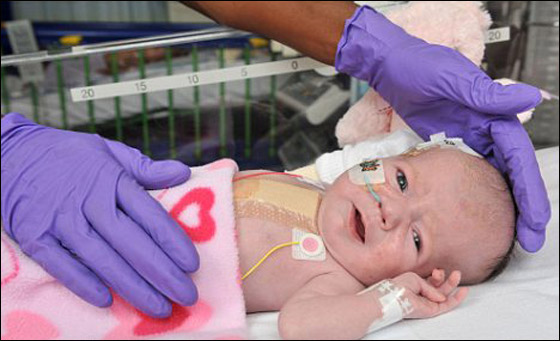 كتب لها الموت قبل ولادتها.. لكن اصرار والديها انقذها! صورة رقم 2 كتب لها الموت قبل ولادتها.. لكن اصرار والديها انقذها! صورة رقم 2