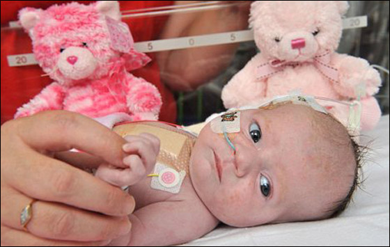 كتب لها الموت قبل ولادتها.. لكن اصرار والديها انقذها! صورة رقم 3 كتب لها الموت قبل ولادتها.. لكن اصرار والديها انقذها! صورة رقم 3