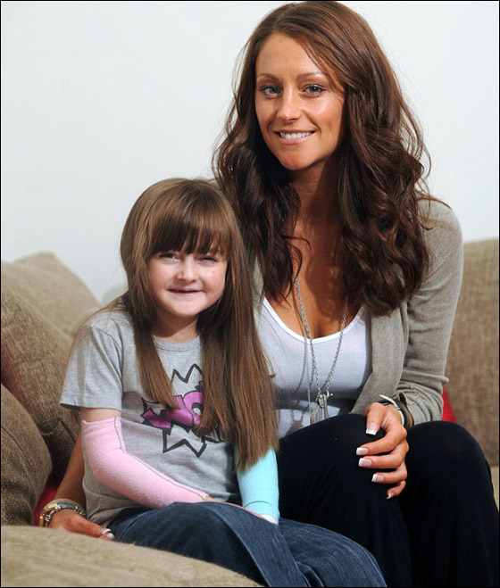 طفلة تحارب الموت يوميا وتعاني من مرض يقشر جلدها عند لمسه! صورة رقم 2